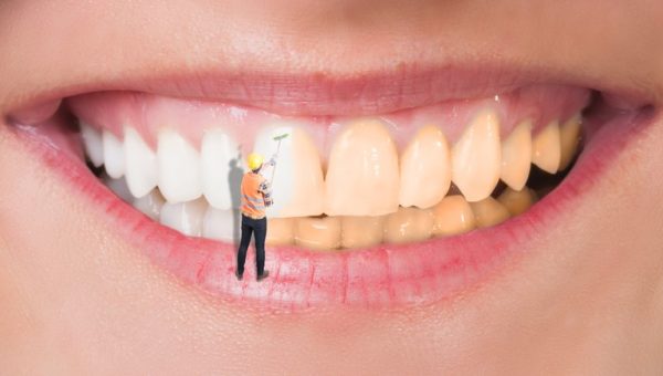 Teeth cleaning vs Teeth Whitening: What is the Difference?